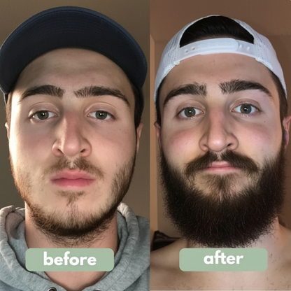 Clevera Hair Growth Roll-On Serum – BFCM Deal | Rosemary + Redensyl + AnaGain